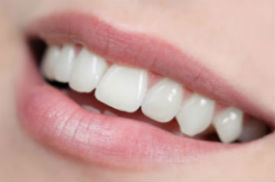 Dental Crowns | Dr. Ly | Divine Dental Solutions | Dentist Elk Grove, CA